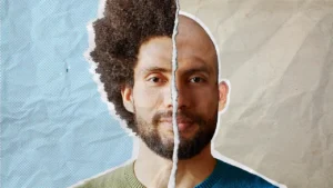 hair loss treatment vizag visakhapatnam hair tranplant prp
