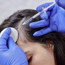 hair treatment hair growth vizag