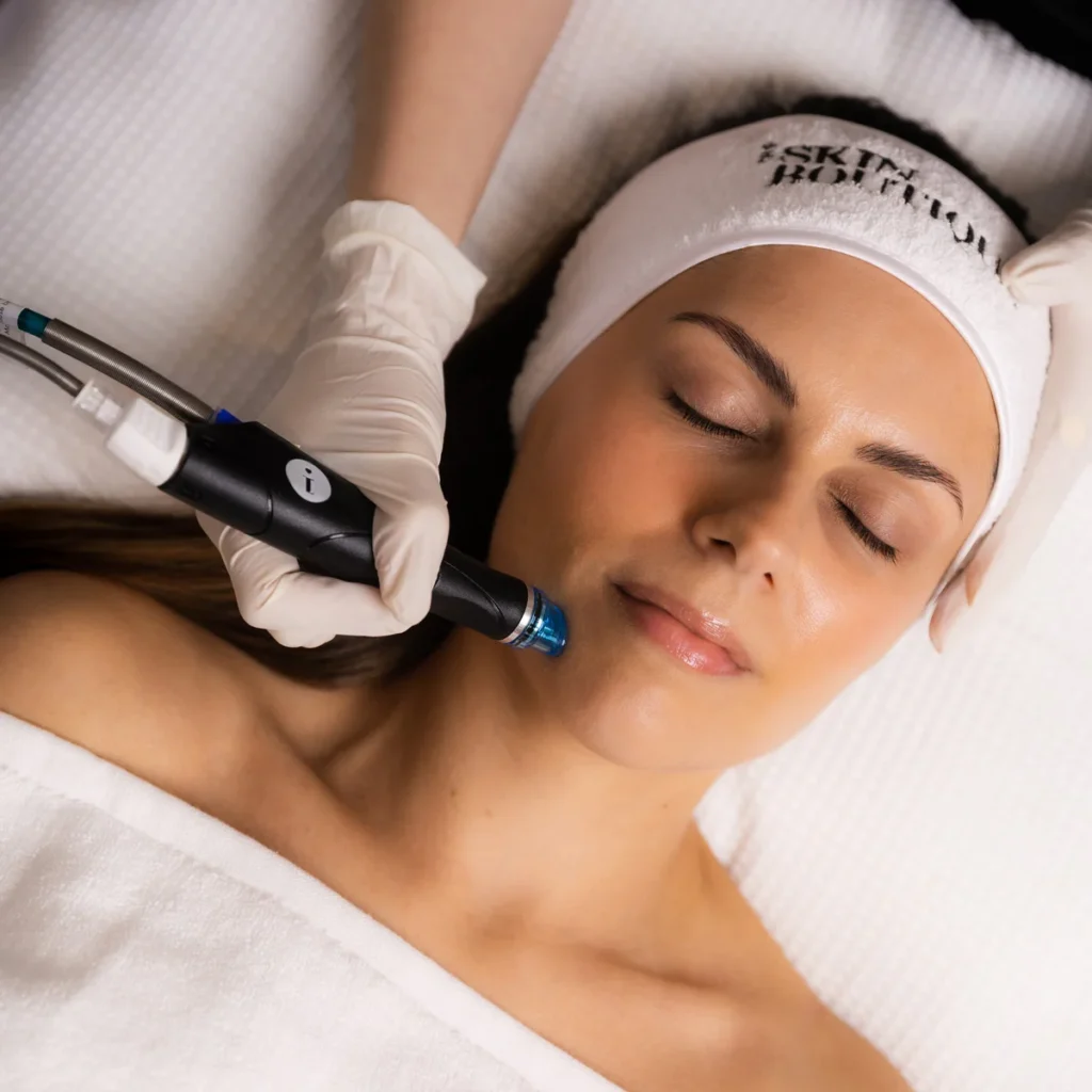 korean hydrafacial vizag hydra facial